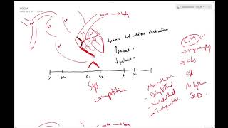 Hypertrophic obstructive cardiomyopathy HOCM  Dr Jamal USMLE [upl. by Adas]