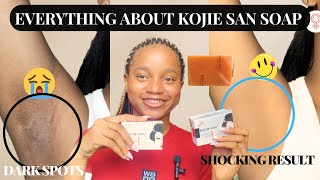 HOW TO EFFECTIVELY USE KOJIE SAN SOAP  Kojie San Soap Detailed Review [upl. by Lockhart]