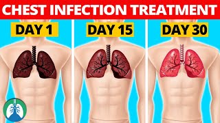 7 Natural Chest Infection Treatments Home Remedies [upl. by Enamrahc]