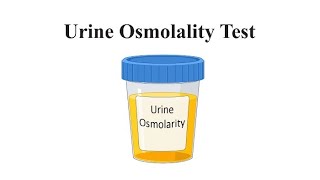 Urine osmolality test purposeprocess  calculation laboratory labtechnicians [upl. by Elena]