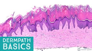 Basic Dermpath Cases  Explained by a Dermatopathologist [upl. by Vi]