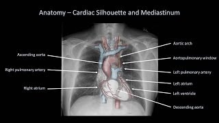 How to Interpret a Chest XRay Lesson 2  A Systematic Method and Anatomy [upl. by Kuo]