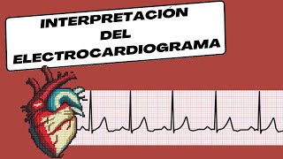 Interpretación del Electrocardiograma [upl. by Harragan409]