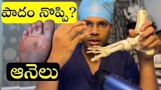 Foot pain  Corn Callosity  Chronic ulcer  Telugu  Dr Ramprasad kancherla [upl. by Irina63]