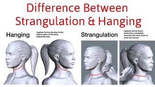 Difference Between Hanging and Strangulation [upl. by Udale]