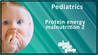 L45 part 4  protein energy malnutrition  Rickets  Pediatrics [upl. by Bathsheeb]