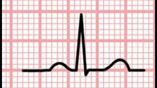 ECG Interpretation  Time and the ECG Section 1 Part 5 [upl. by Bodnar]