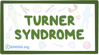 Turner syndrome Year of the Zebra [upl. by Elga]