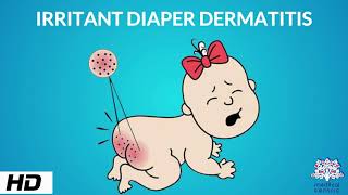 Irritant Diaper Dermatitis Causes Signs and Symptoms Diagnosis and Treatment [upl. by Enak]