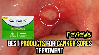 🌟 Banish Canker Sores FAST Top 3 Treatments Reviewed amp How to Use Them 🔥 [upl. by Eemaj]