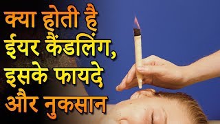 Ear Candling for Wax Removal  क्या होती है ईयर कैंडलिंग  Purvi Beauty amp Fashion [upl. by Inaleon339]