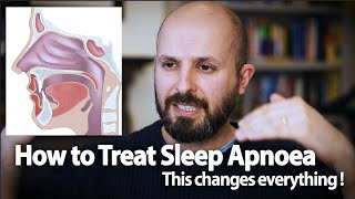 How to Treat Sleep Apnoea  This Changes Everything [upl. by Browne731]