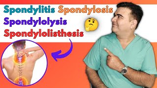 Discover the Key Differences Spondylitis vs Spondylosis vs Spondylolysis vs Spondylolisthesis [upl. by Lussi]