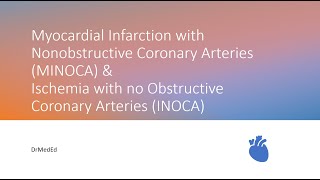 Myocardial Infarction with Nonobstructive Coronary Arteries MINOCA amp INOCA [upl. by Schlessinger357]