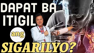 Dapat Ba Itigil ang Sigarilyo  By Doc Willie Ong 1084 [upl. by Lourie]