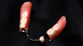 Cleaning Partial Dentures [upl. by Hannahs]