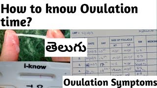 Telugu How to know Ovulation period  Ovulation symptoms [upl. by Niamjneb228]