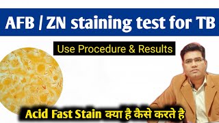 What is AFB  ZN Stain Test For TB  Full form Use and Procedure of Acid Fast Bacilli test [upl. by Omissam583]