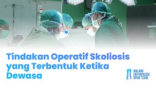 Tindakan Operatif pada Kasus Skoliosis yang Terjadi Ketika Beranjak Dewasa [upl. by Barrus590]