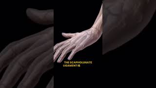 scapholunate ligament tear [upl. by Swirsky]