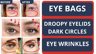 ANTIAGING FACE EXERCISES FOR EYE BAGS EYE WRINKLES DARK CIRCLES amp TIGHTEN DROOPY EYELIDS [upl. by Ranee729]