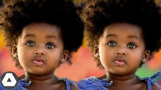 10 Rarest Black Twins Who Are One In a Million [upl. by Ainel]