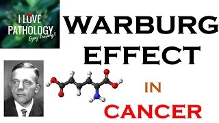 NEOPLASIA 6 WARBURG EFFECT Hallmark of CANCER What Why amp How [upl. by Corabel]