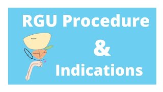 RGU procedure amp its indication [upl. by Sarkaria]