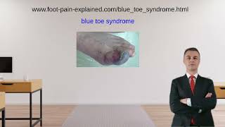 blue toe syndrome [upl. by Rahm279]