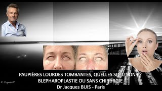 PAUPIERES LOURDES TOMBANTES  QUELLES SOLUTIONS  AVEC BLEPHAROPLASTIE OU SANS CHIRURGIE Dr BUIS J [upl. by Enelime]