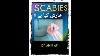 scabiesscabies ka ilajscabies home treatmentscabies treatment scabies symptomshealth everywhere [upl. by Yrok]