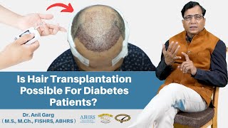 Is Hair Transplantation Possible For Diabetes Patients Dr Anil Garg [upl. by Kjersti712]