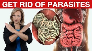 9 Tips to Get Rid of Parasites amp Candida  Dr Janine [upl. by Silvie]