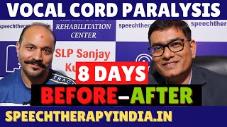 BeforeAfter  Unilateral Vocal Cord Paralysis Phonatory Gap  8 Days Treatment  slpsanjaykumar [upl. by Ahsitram]