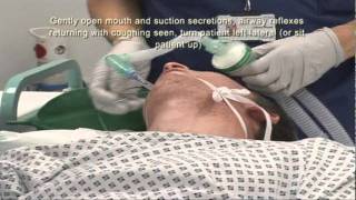 Intubation Extubation 67 [upl. by Enortna]