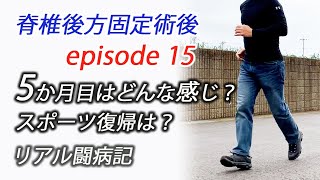 脊椎後方固定術後5か月経過・テニス復帰はどんな感じ？ [upl. by Lennox362]