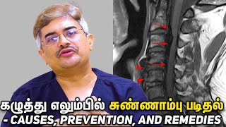 Extra Bone Growth in Neck Bone  Causes Prevention and Remedies DrRoopesh Kumar [upl. by Nnaesor]