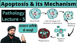 Apoptosis  Programmed Cell Death  Mechanism  Intrinsic amp Extrinsic Pathway  Pathology Lecture [upl. by Ettevahs]