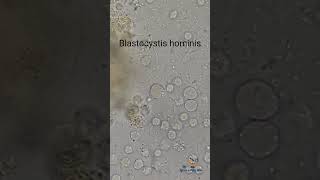 Blastocystis hominis in Stool [upl. by Anais]