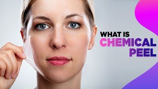 Chemical Peel 101 Everything You Wanted To Know [upl. by Chico]