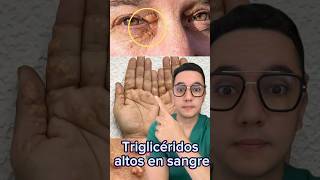 Señales de que tienes los triglicéridos altos en sangre  Dr William Guerrero medicina shorts [upl. by Ojiram]