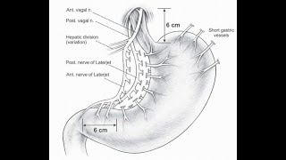 Discuss Nerves of Latarjet Laterjet or Posterior nerves of lesser curvature of the stomach [upl. by Atinrahc]