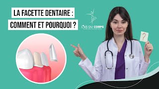 LA FACETTE DENTAIRE  COMMENT ET POURQUOI   Las du corps [upl. by Colleen]