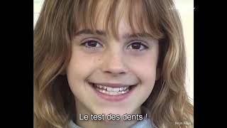 VOSTFR Emma Watson essaye les fausses dents dHermione Granger 2000 [upl. by Remle934]