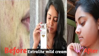 xtralite mild cream Dark spot remover cream  Dailyvlogerpriyanka [upl. by Animas]