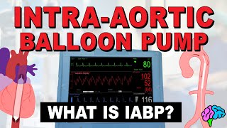 What is an IntraAortic Balloon Pump IABP [upl. by Yekim]