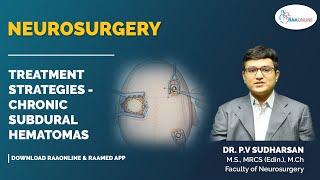 Neurosurgery  Treatment Strategies  Chronic Subdural Hematomas  Raaonline neurosurgery [upl. by Gib]