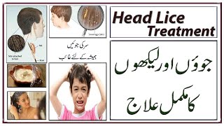 HEAD LICE Treatment  3 Easy and Fast Ways ll سر کی جوؤں اور لیکھوں کا مکمل خاتمہ [upl. by Kassab]