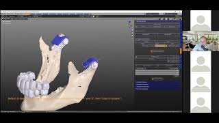 B4D ZOOM Articulator and Facebow [upl. by Orland]