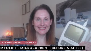 Myolift Microcurrent Device  Before amp After 30 Uses [upl. by Sesom]